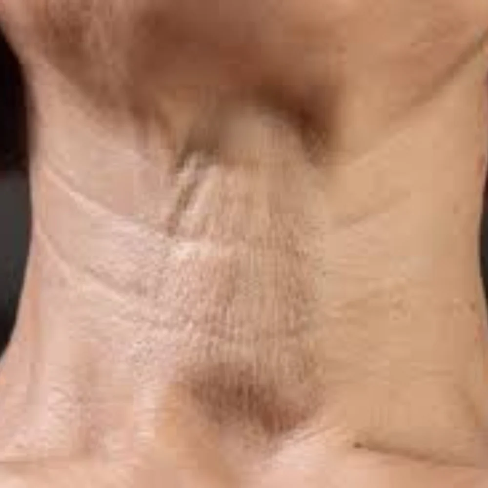 Neck