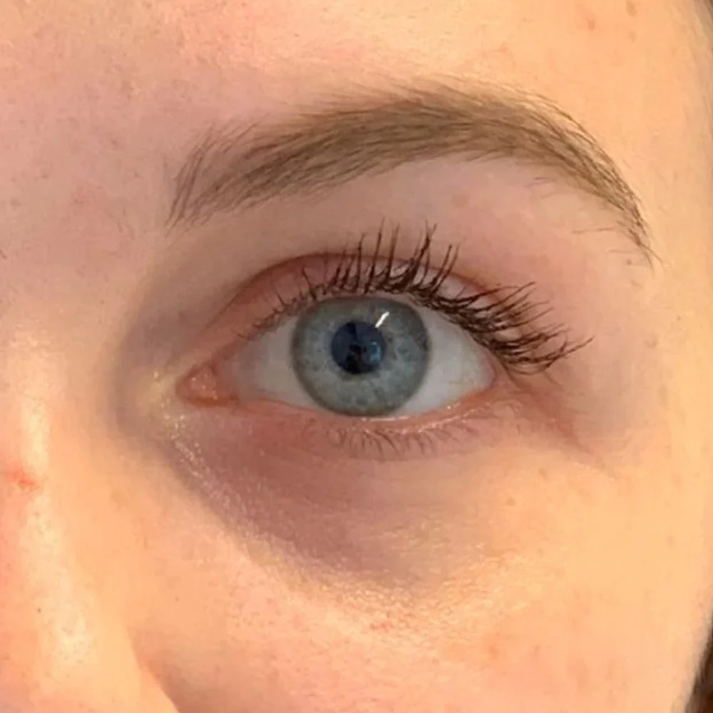 Under Eyes